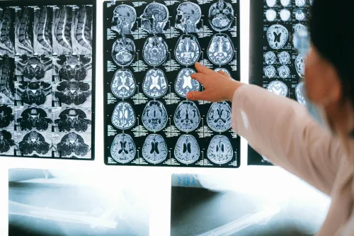 Biopsychology B (Effects of Brain Damage & Drugs) Online Course