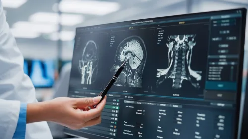 Neurologist looking at brain scans.